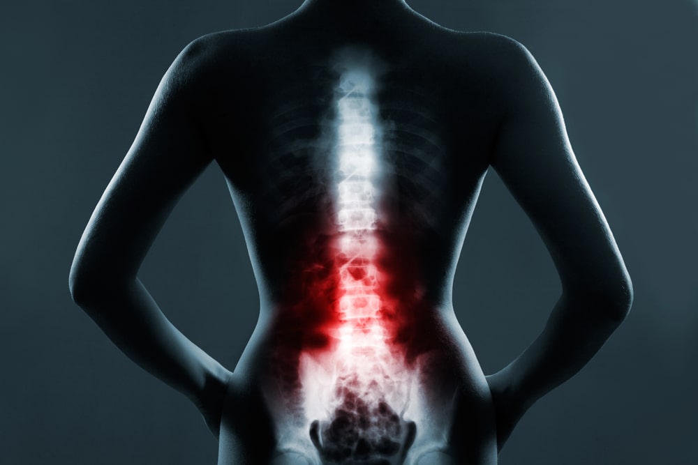 spinal cord injury lawyer Coconut Creek, FL